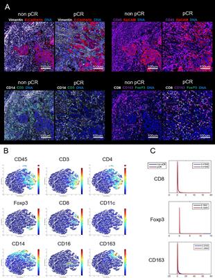 Tumor-Infiltrating Cytotoxic T Cells and Tumor-Associated Macrophages Correlate With the Outcomes of Neoadjuvant Chemoradiotherapy for Locally Advanced Rectal Cancer